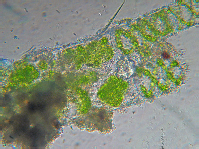 Coniugazione di Spirogyra